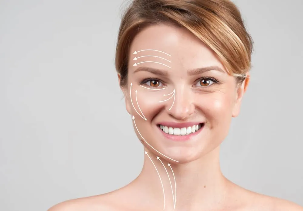 Smiling woman with face lift lines on skin, indicating cosmetic surgery or skincare treatment benefits.